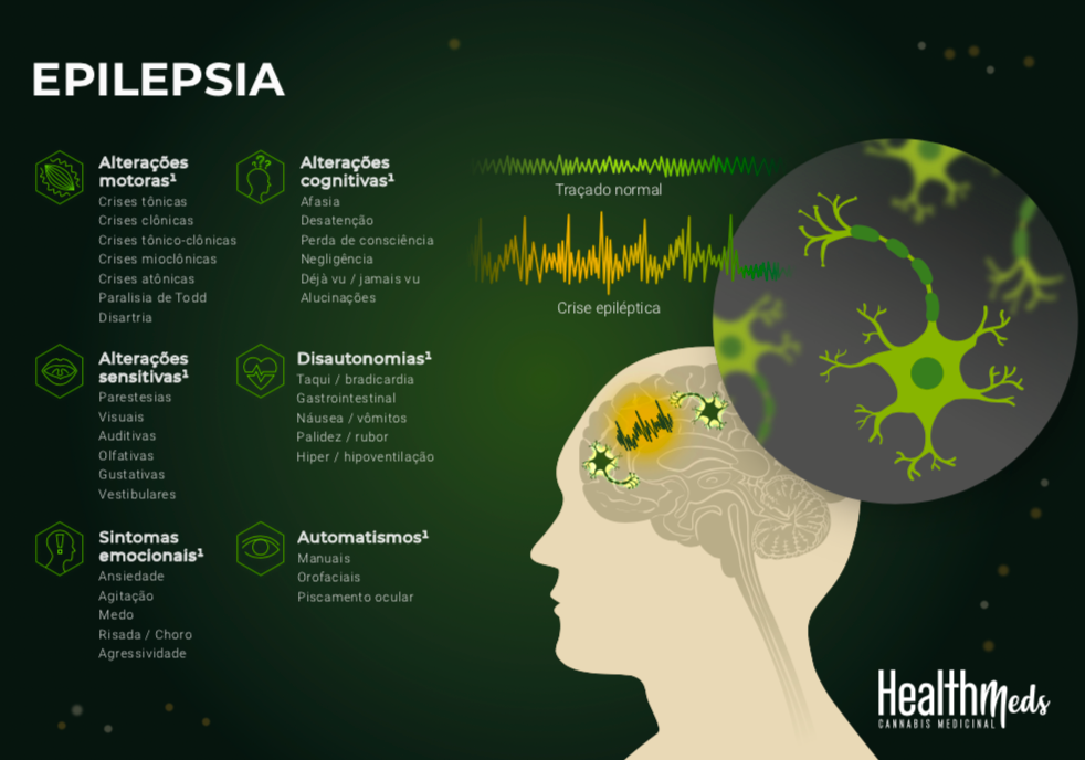 Lâmina sobre o uso da Cannabis Medicinal nas Epilepsias Farmacorresistentes Lâmina sobre o uso da Cannabis Medicinal nas Epilepsias Farmacorresistentes